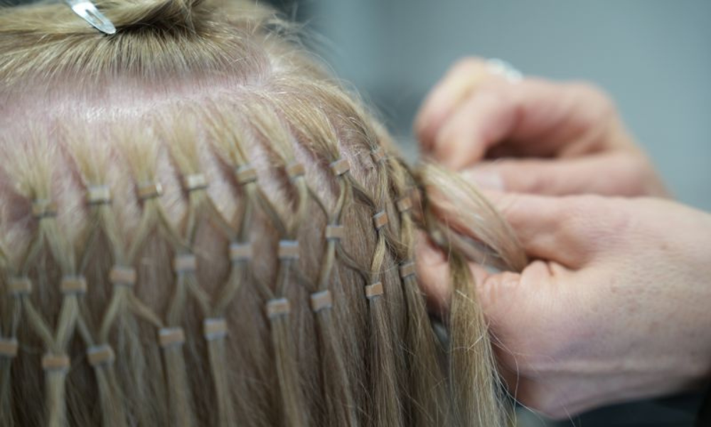 Vue des points de fixation d'une pose tissage pour alopécie