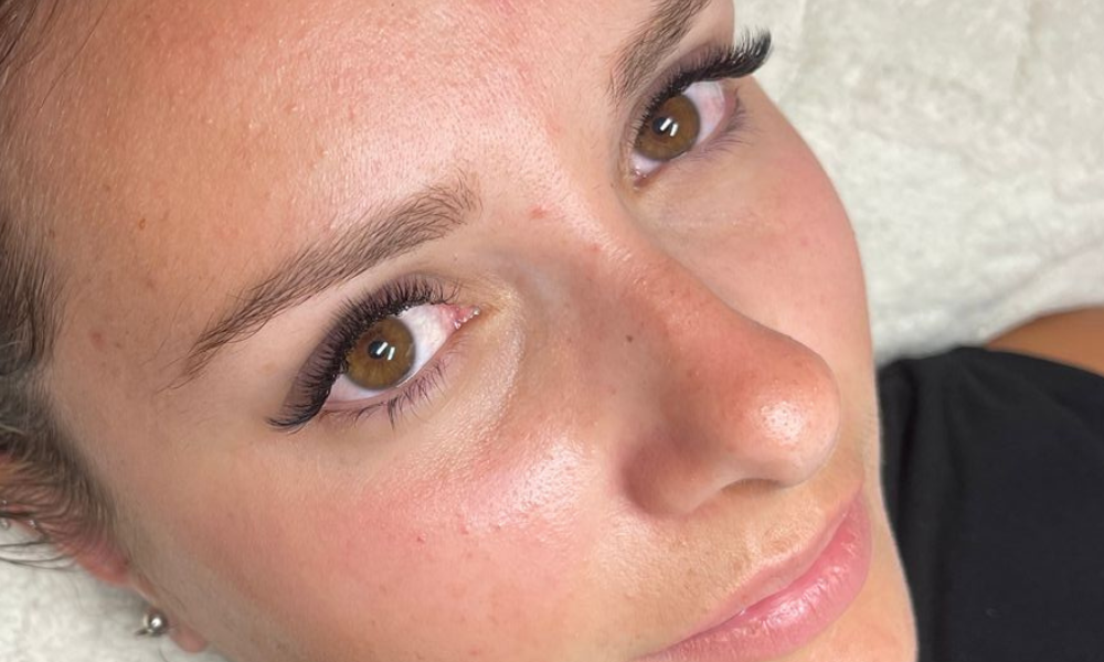 Sourcils lors d'une formation browlift